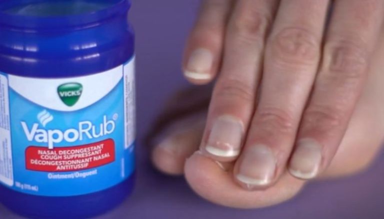 15. Get Rid Of Nail Fungus