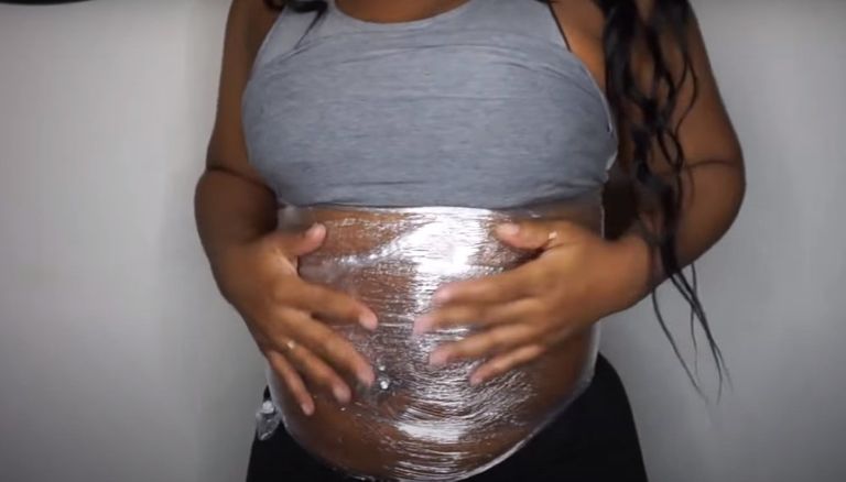 23. Stretch Marks