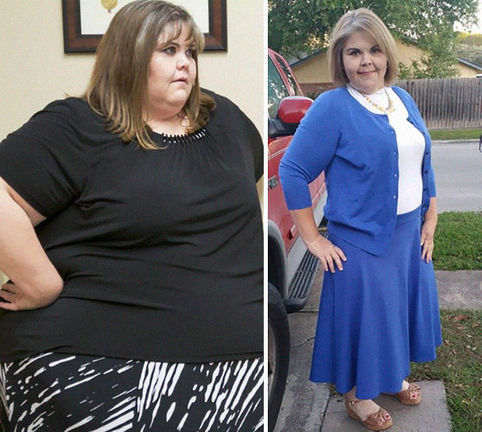 Here S Where These My 600 Pound Life Participants Are Today Sizzlfy